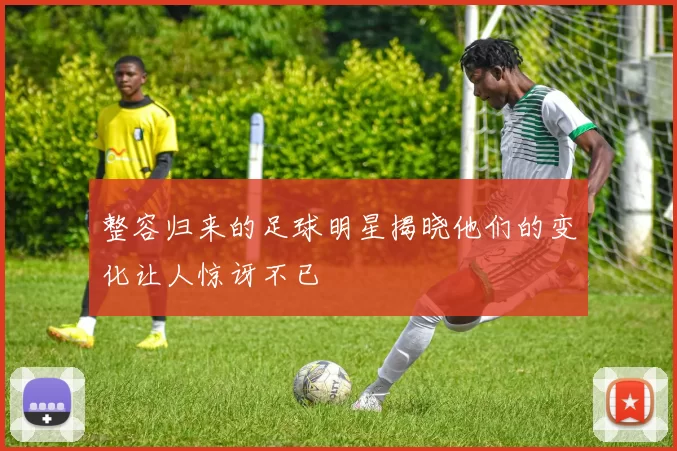 整容归来的足球明星揭晓他们的变化让人惊讶不已